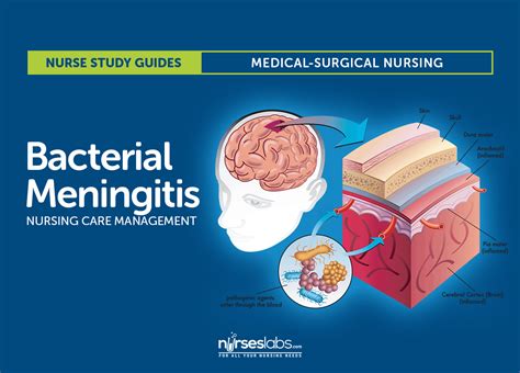 nursing diagnosis for bacterial meningitis